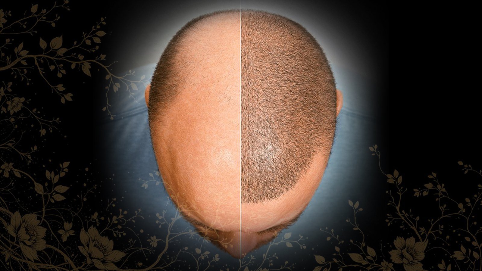 Hair Implement